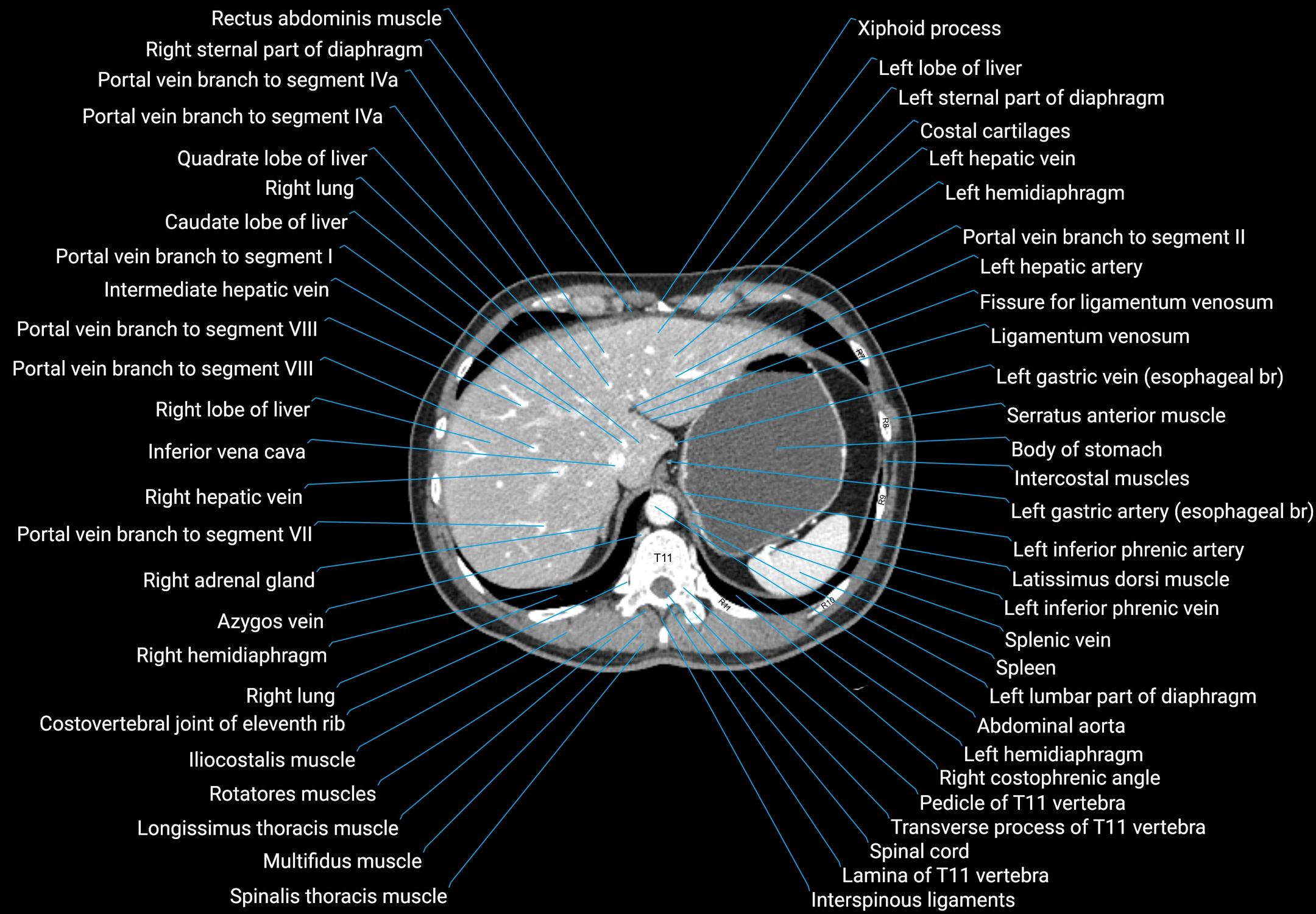 CT Abdomen and Pelvis (Male) Anatomy – Axial, Coronal & Sagittal ...