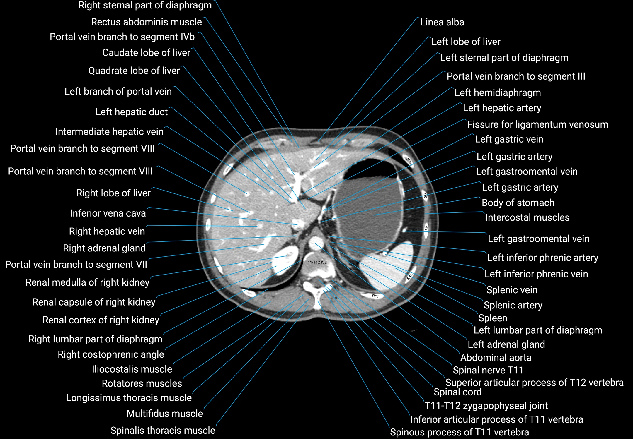 CT Abdomen and Pelvis (Male) Anatomy – Axial, Coronal & Sagittal ...