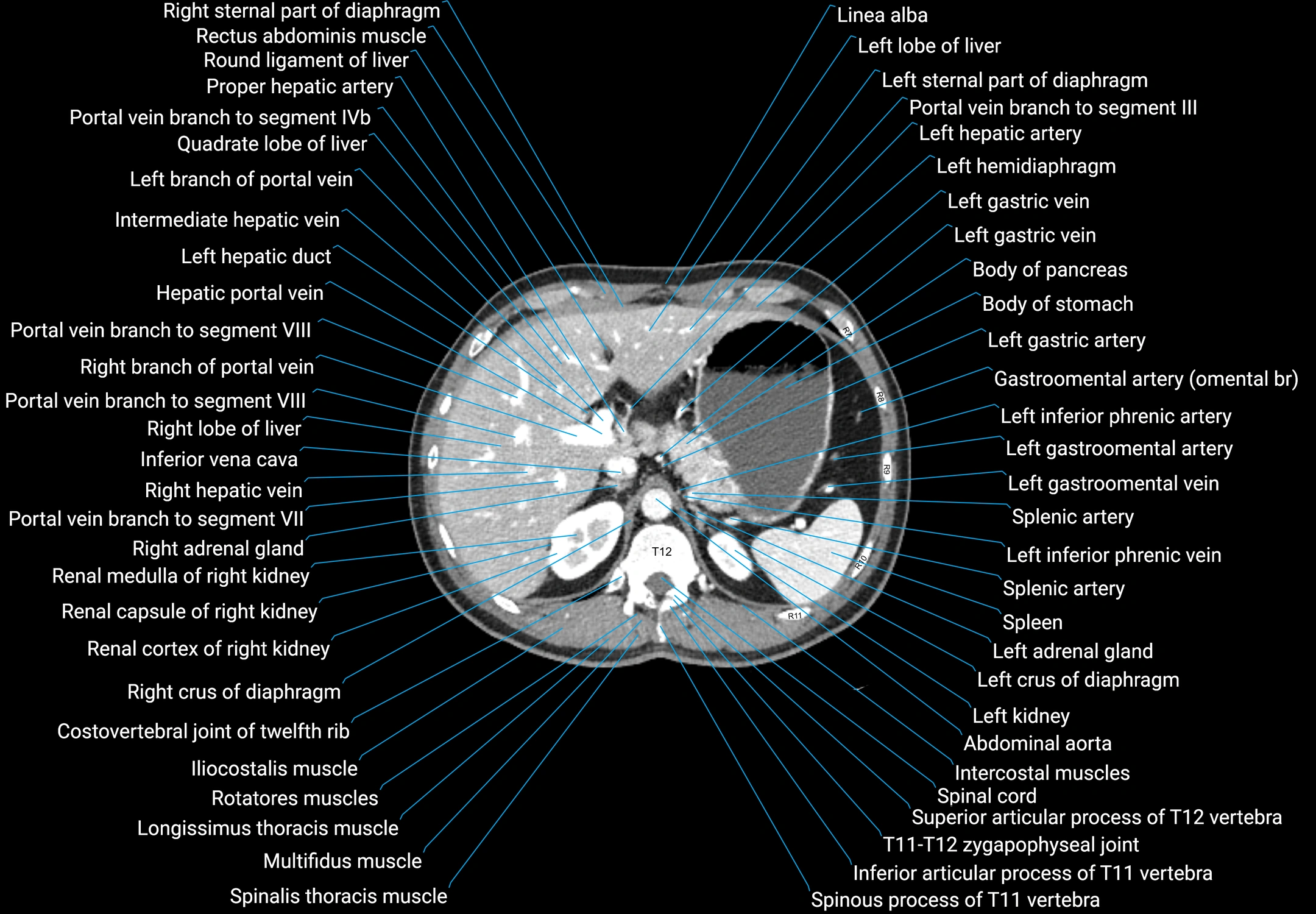 CT Abdomen and Pelvis (Male) Anatomy – Axial, Coronal & Sagittal ...