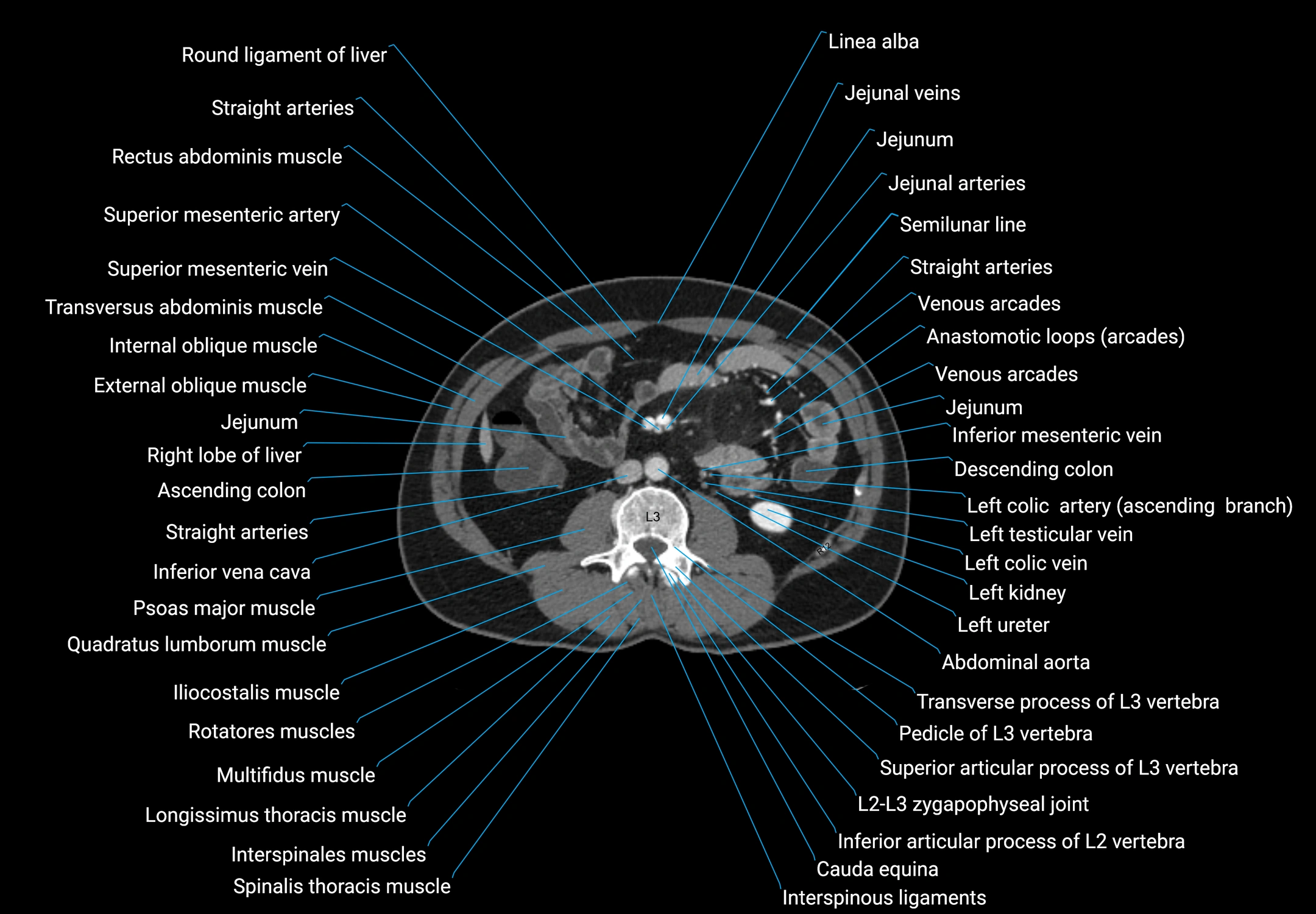 CT Abdomen and Pelvis (Male) Anatomy – Axial, Coronal & Sagittal ...