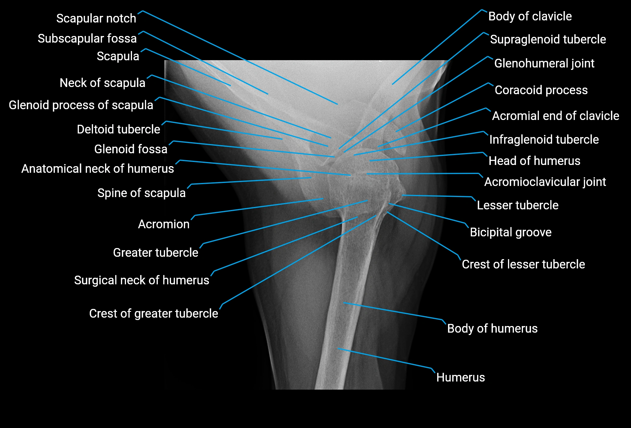 Normal Axillary View Shoulder X-Ray Anatomy – AP & Lateral Views | Labeled Normal Images