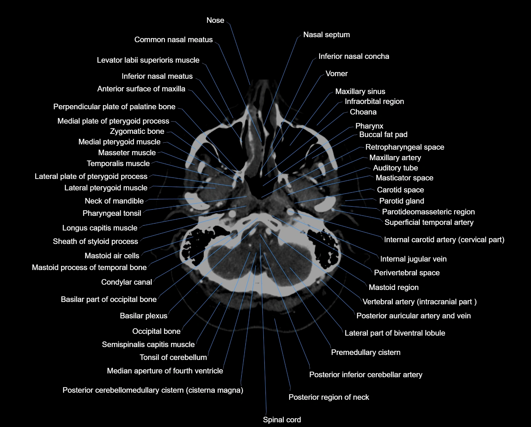 CT_scan_brain_axial_labelled_cross_sectional_anatomy_image-img-00006.webp