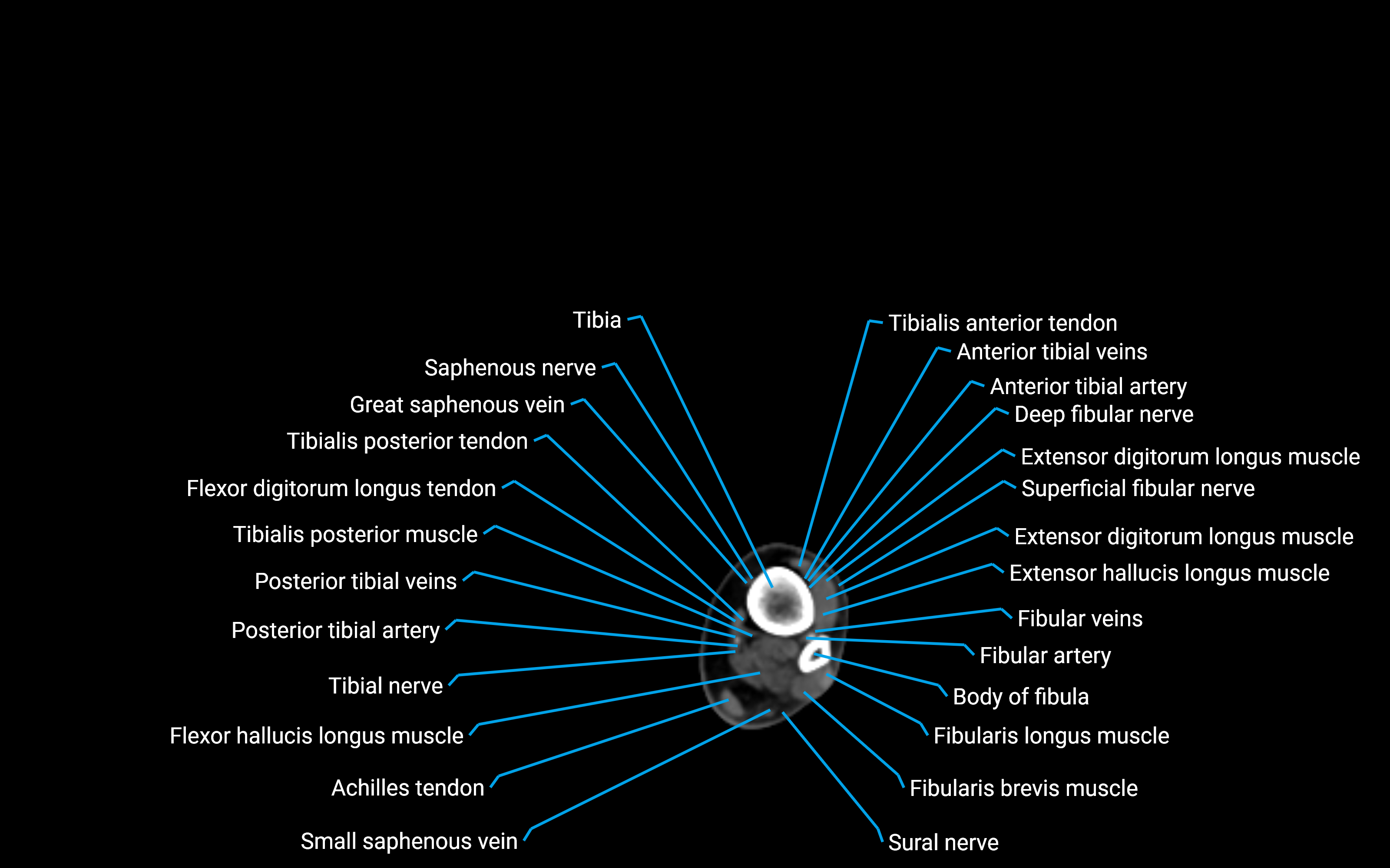 CT Lower Leg Anatomy – Labeled Axial, Sagittal & Coronal Views