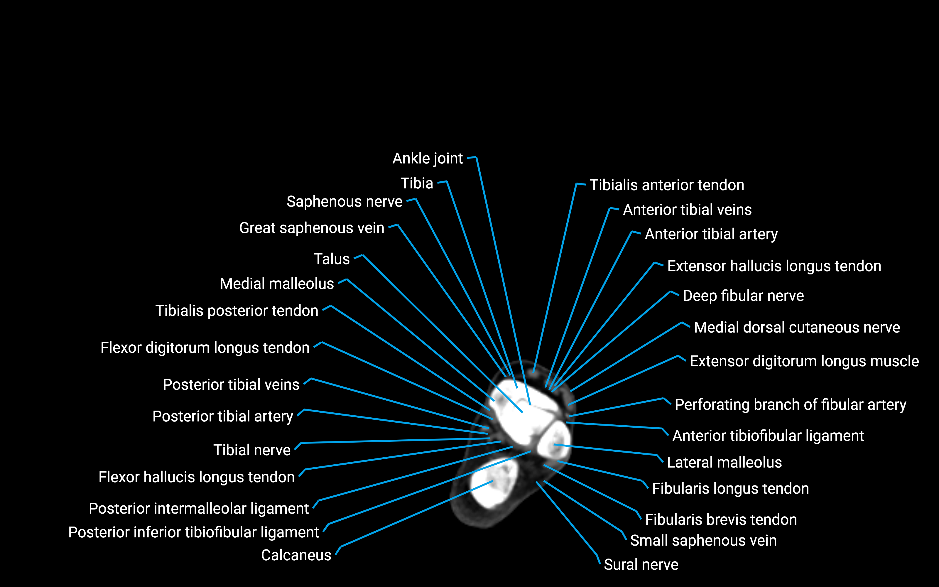 CT Lower Leg Anatomy – Labeled Axial, Sagittal & Coronal Views