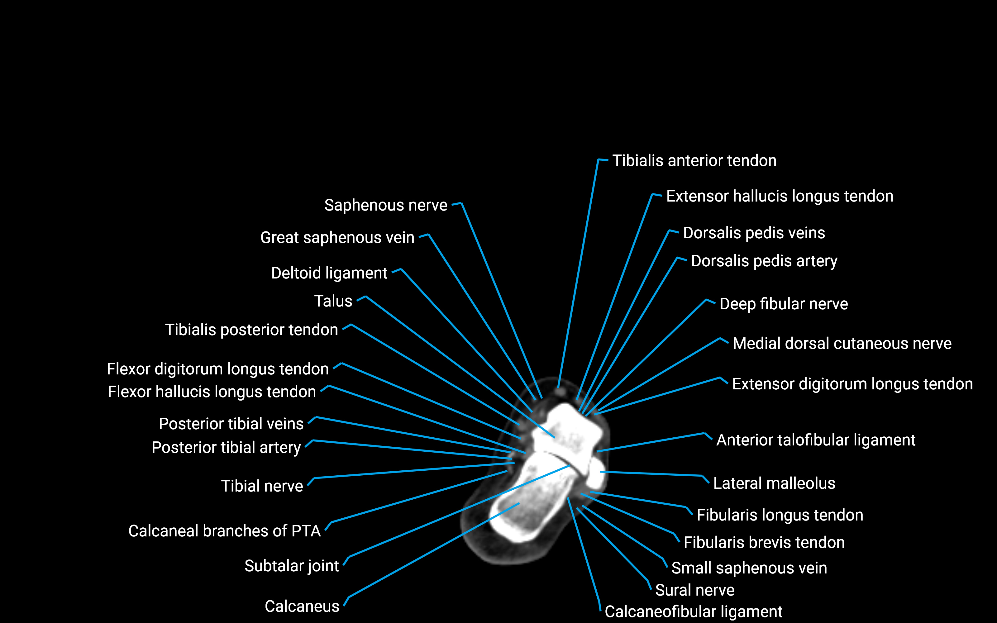 CT Lower Leg Anatomy – Labeled Axial, Sagittal & Coronal Views