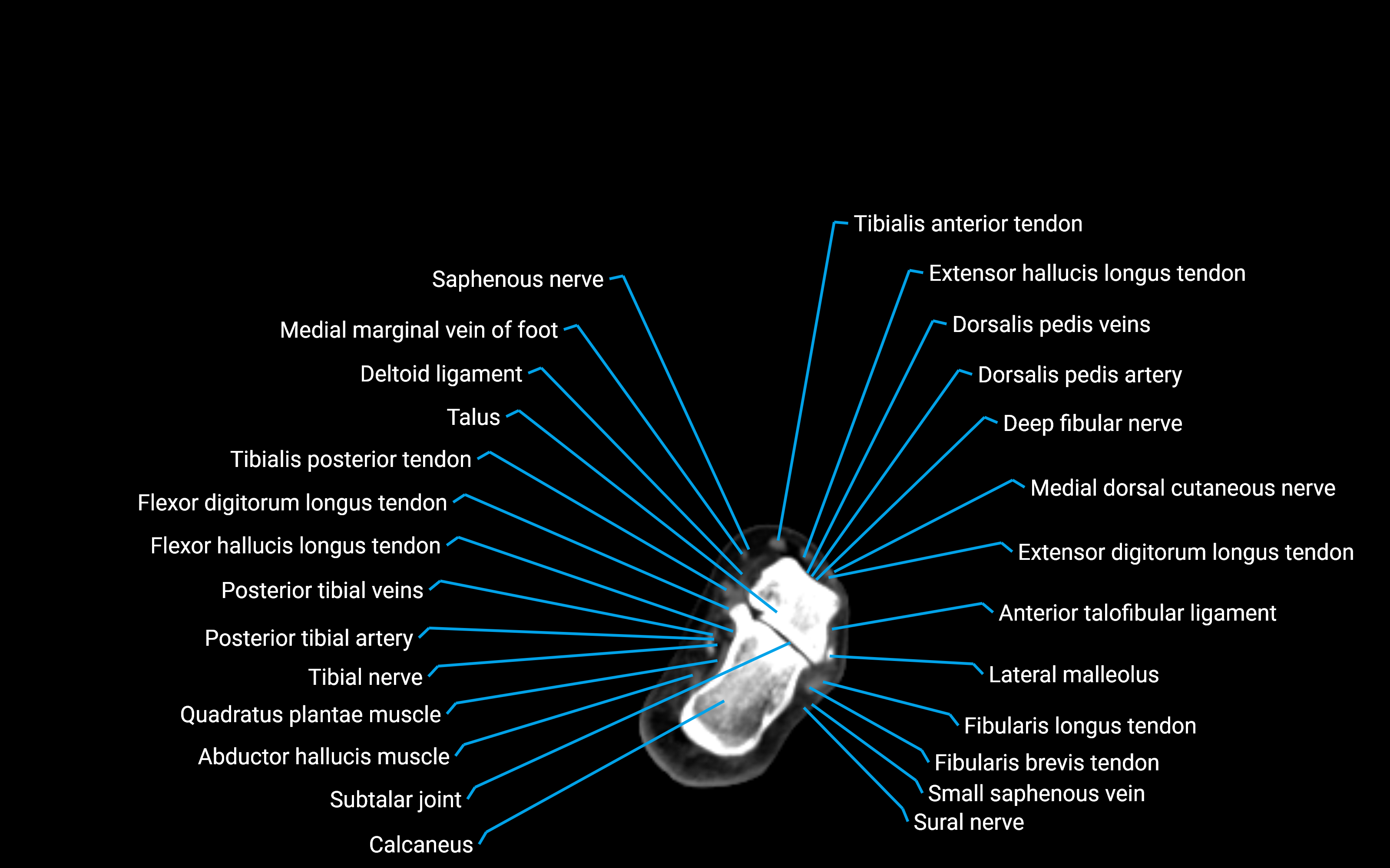 CT Lower Leg Anatomy – Labeled Axial, Sagittal & Coronal Views