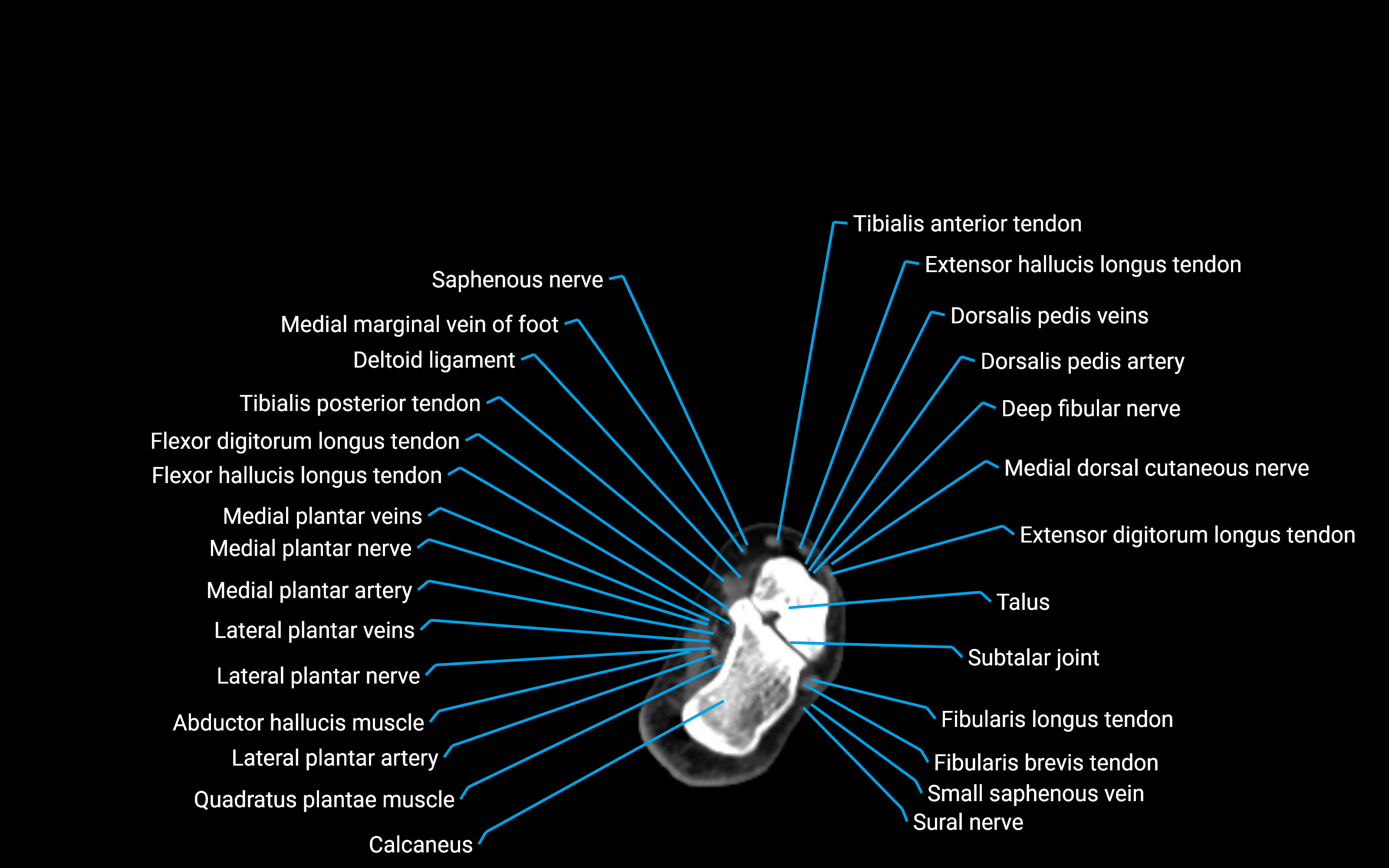 CT Lower Leg Anatomy – Labeled Axial, Sagittal & Coronal Views