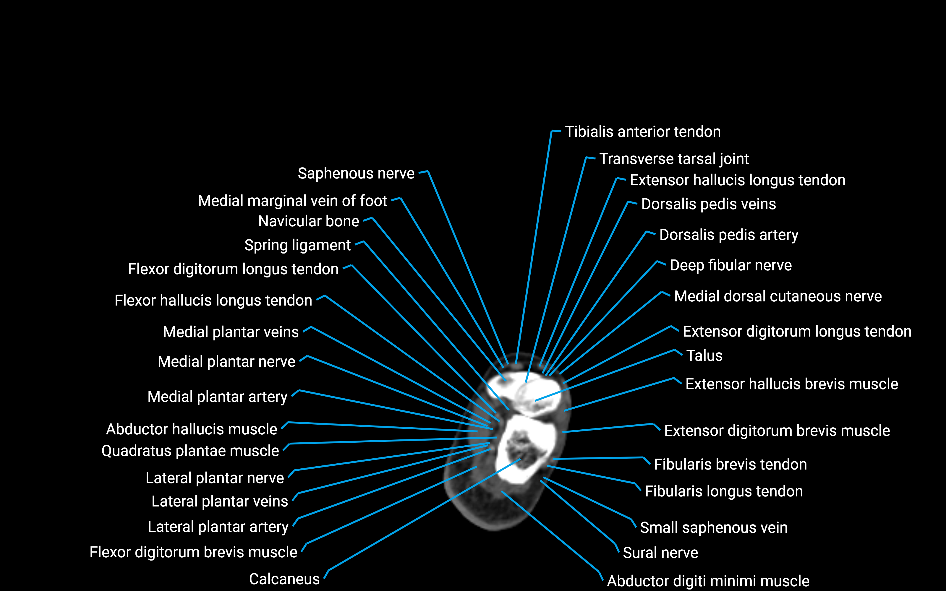 CT Lower Leg Anatomy – Labeled Axial, Sagittal & Coronal Views