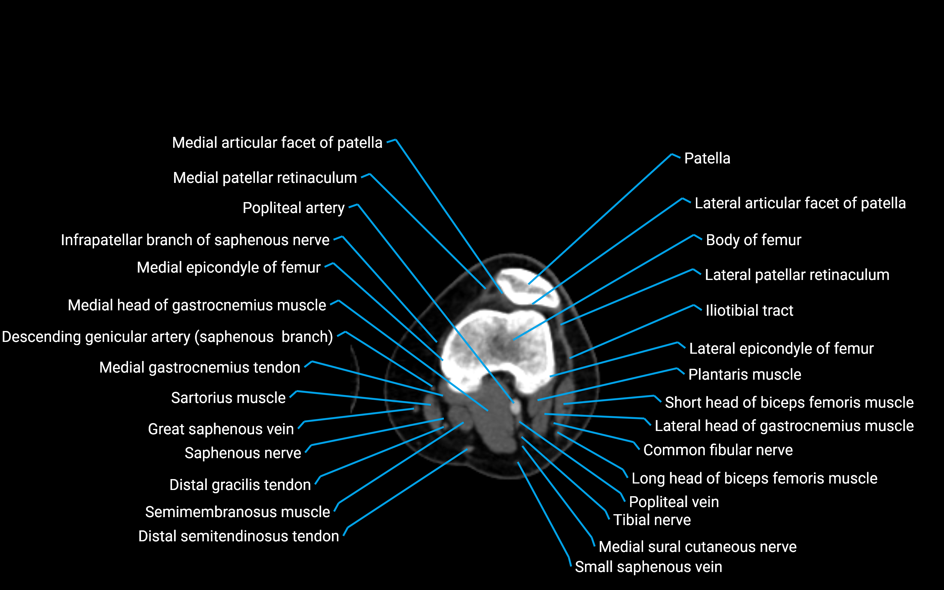 CT Lower Leg Anatomy – Labeled Axial, Sagittal & Coronal Views