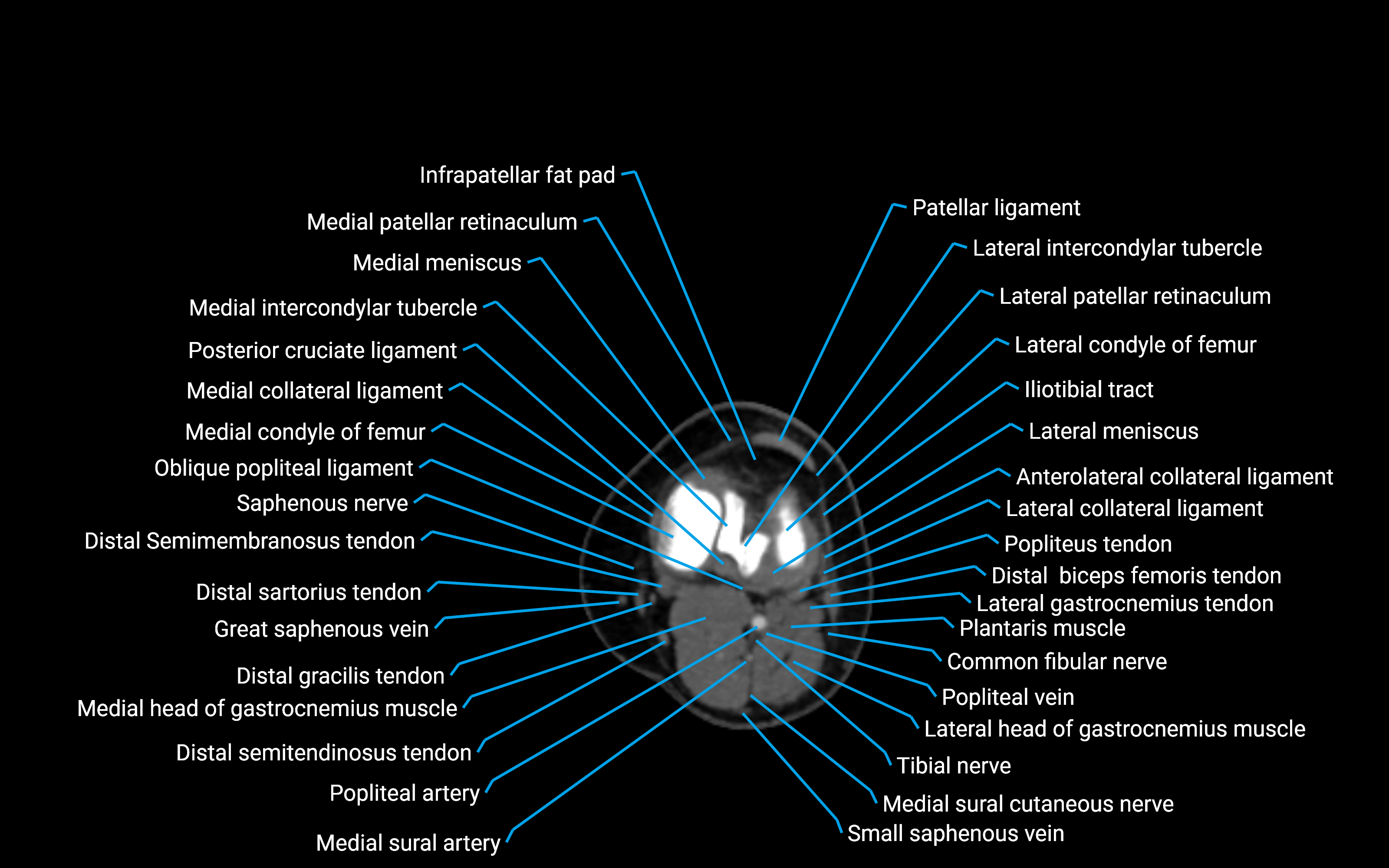 CT Lower Leg Anatomy – Labeled Axial, Sagittal & Coronal Views