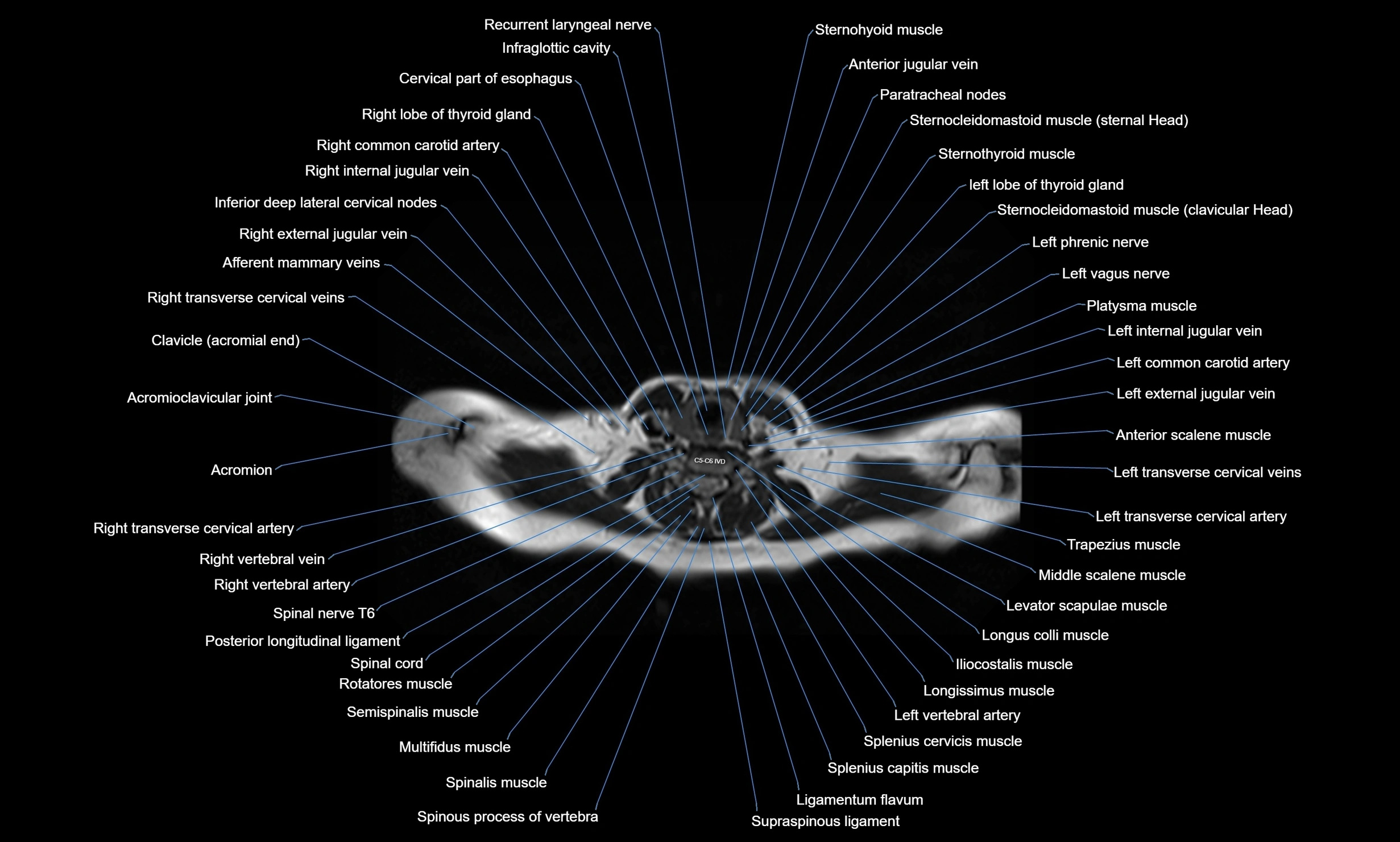 MRI Chest Anatomy – Axial, Coronal & Sagittal Planes with Labeled Images