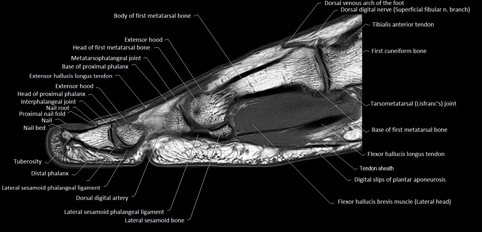 MRI Great Toe Anatomy – Labeled Axial, Coronal & Sagittal Cross-Sections