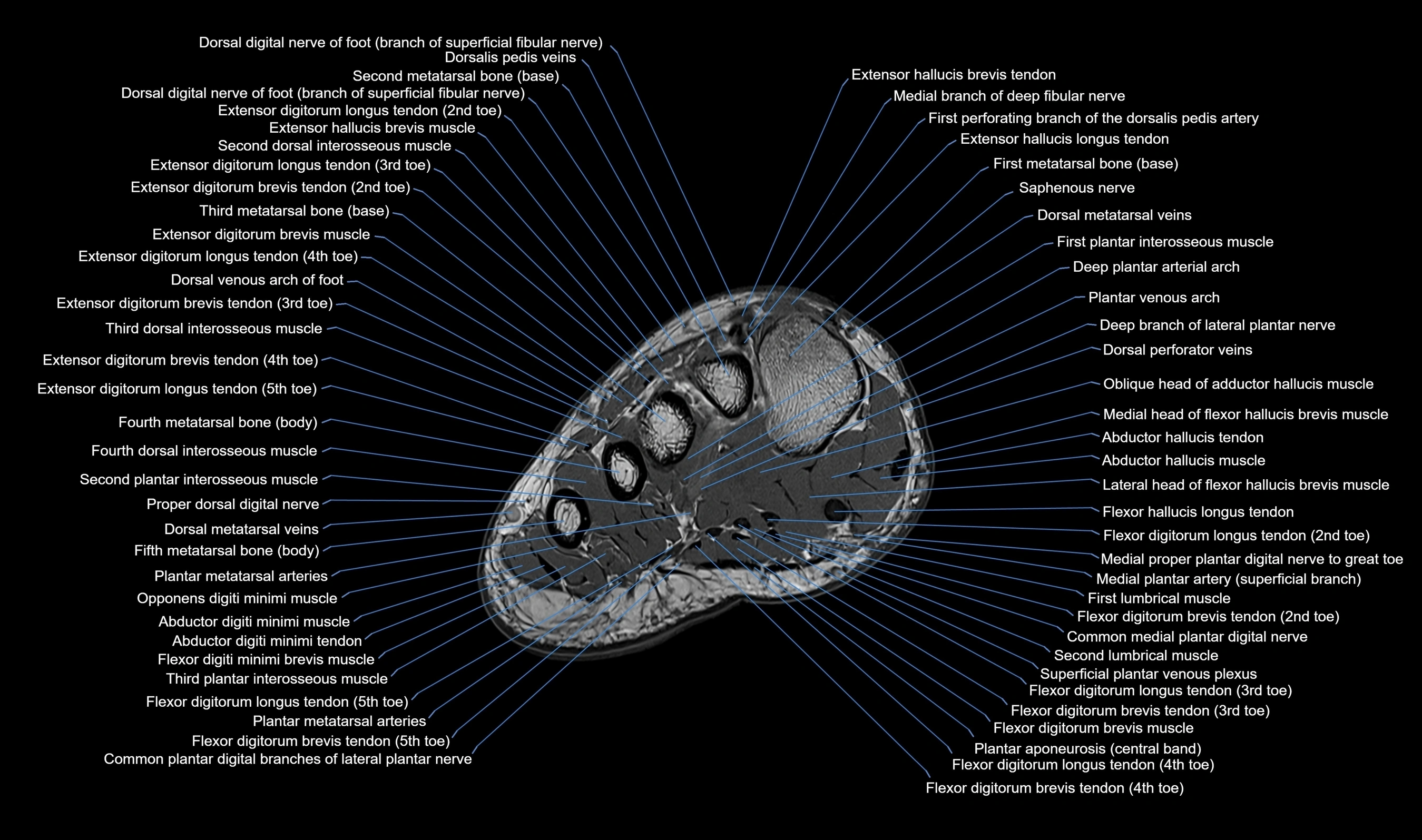 Midfoot Radiology MRI Midfoot Anatomy – Axial, Coronal & Sagittal Labeled Cross-Section ...