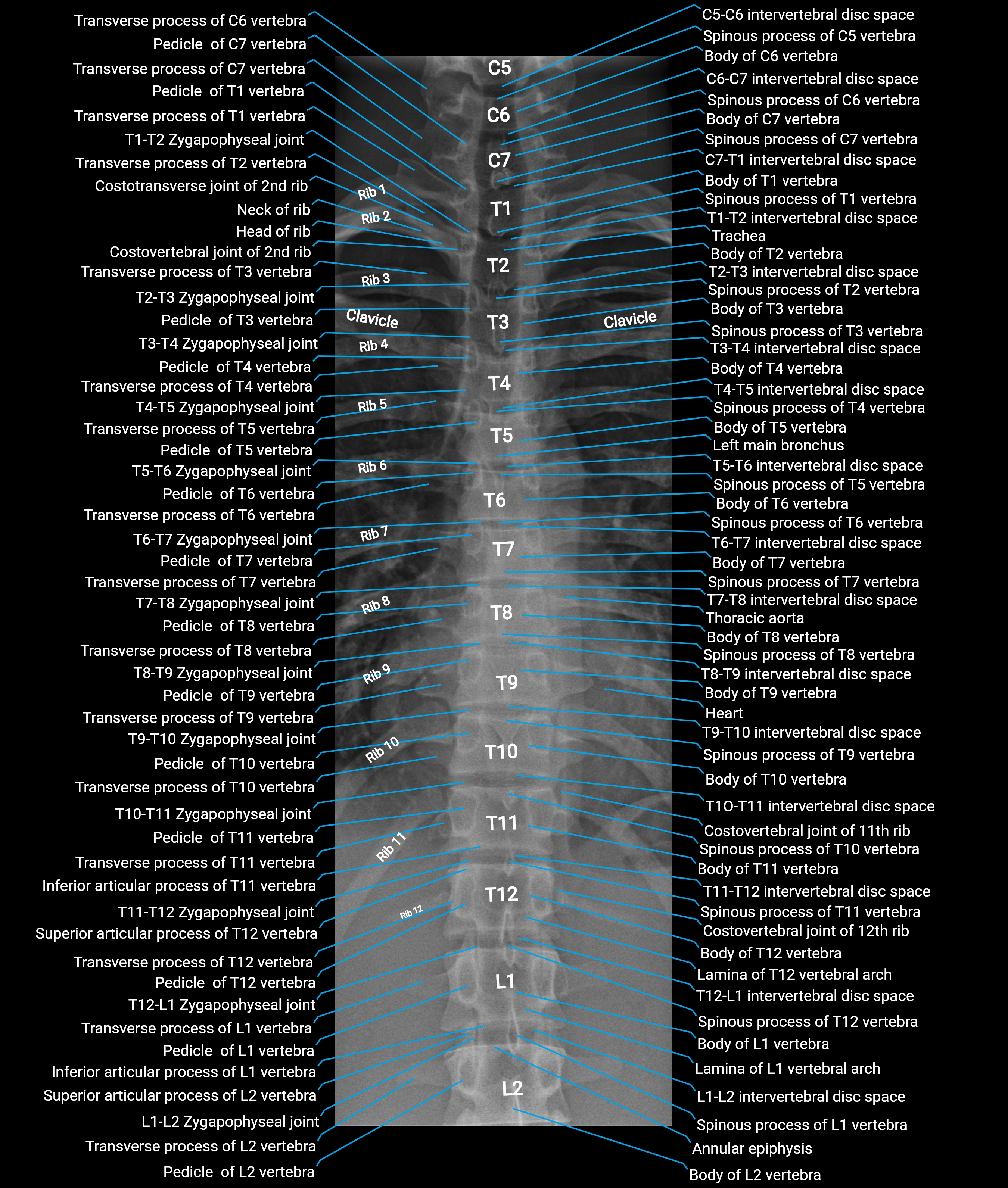 Thoracic Spine X-Ray Anatomy – AP & Lateral Views | Labeled Normal Images