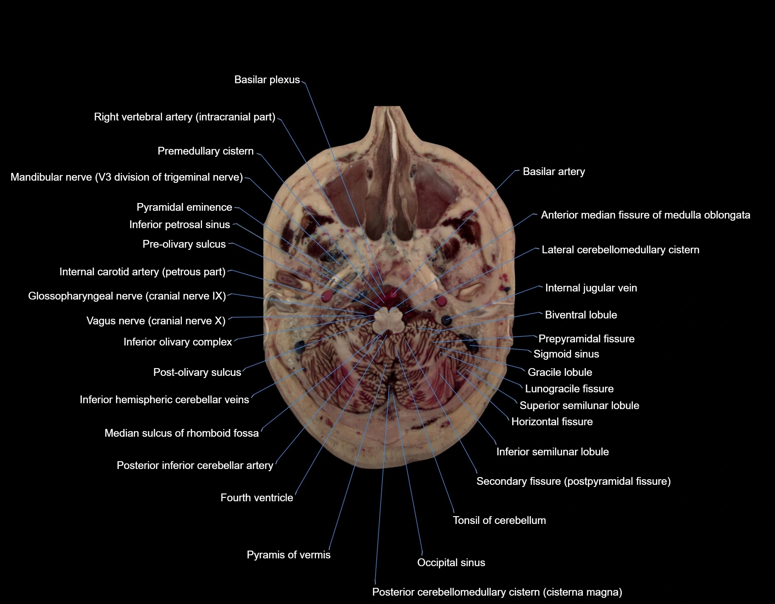 Visible-Human-Project-brain-Axial-cross-sectional-labelled-anatomy---img-000012.webp