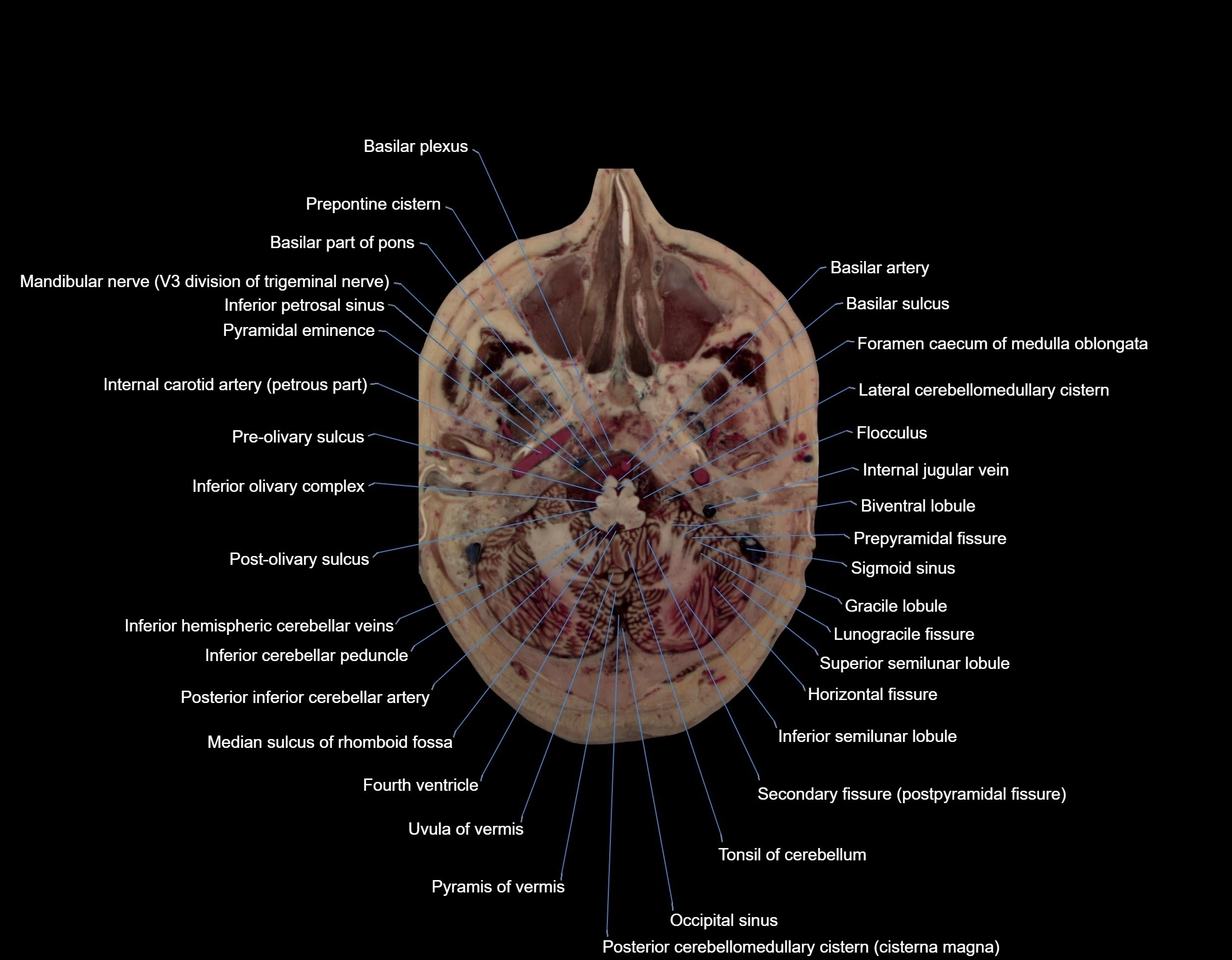 Visible-Human-Project-brain-Axial-cross-sectional-labelled-anatomy---img-000013.webp