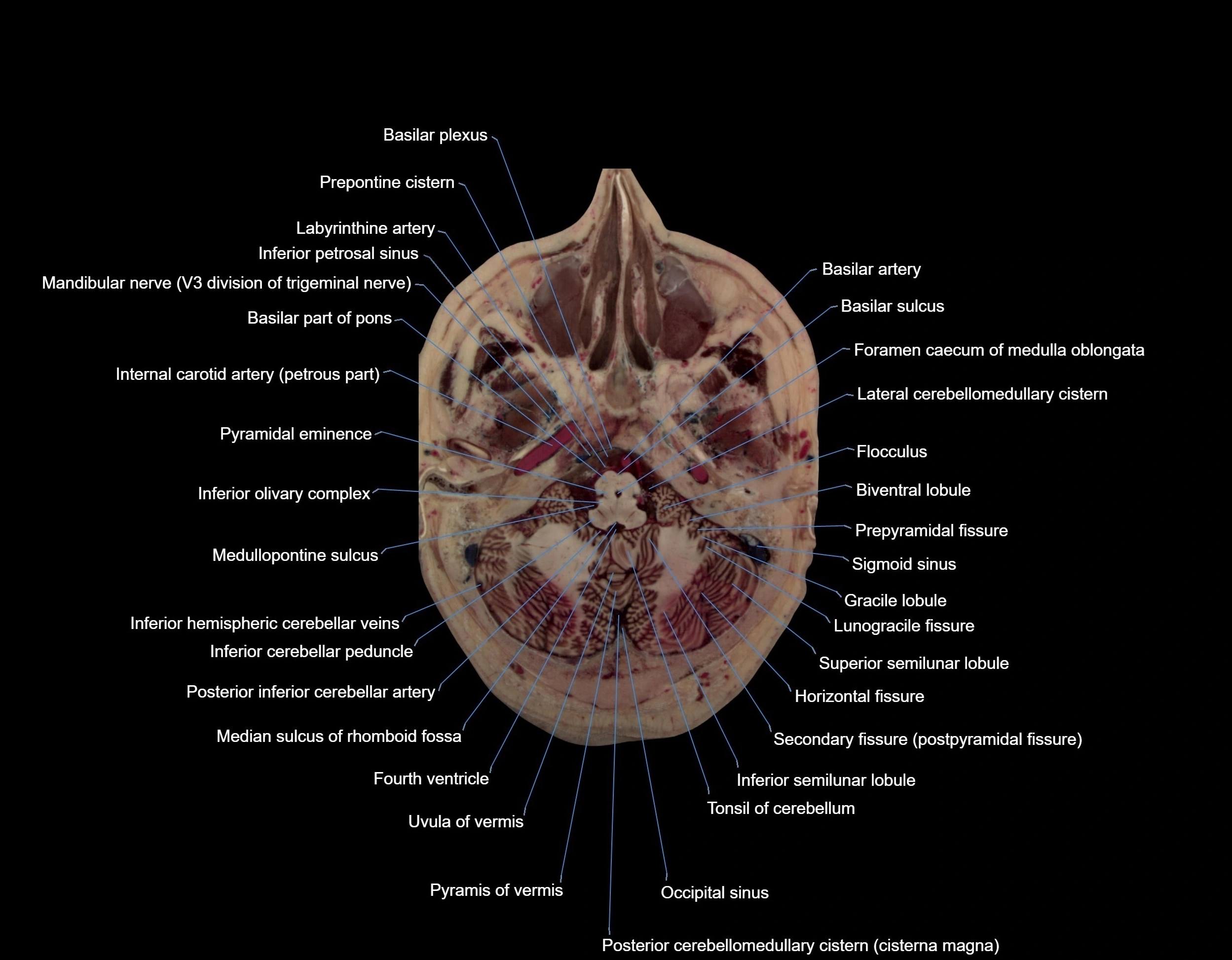Visible-Human-Project-brain-Axial-cross-sectional-labelled-anatomy---img-000014.webp
