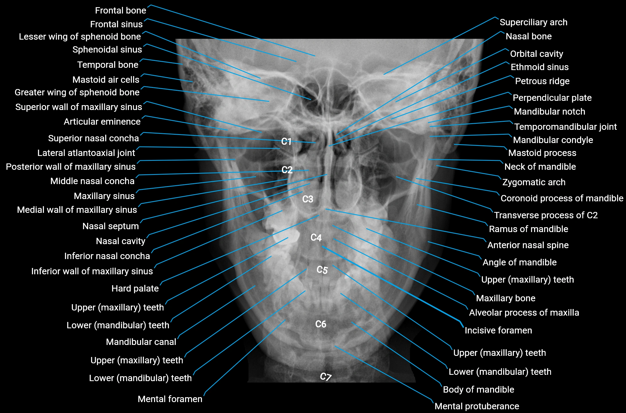Mandible X-Ray Anatomy Labeled | PA & Lateral Views Explained