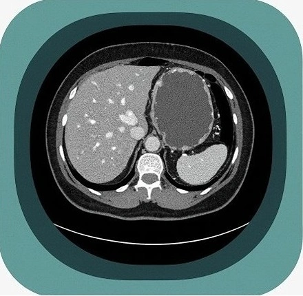 CT Anatomy Atlas – Labelled Cross Sectional CT Images in 3 Planes