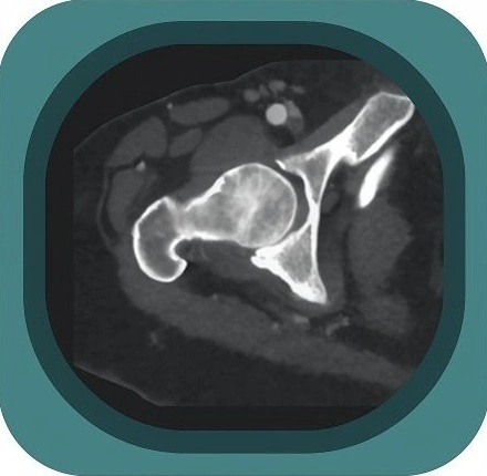 CT Anatomy Atlas – Labelled Cross Sectional CT Images in 3 Planes