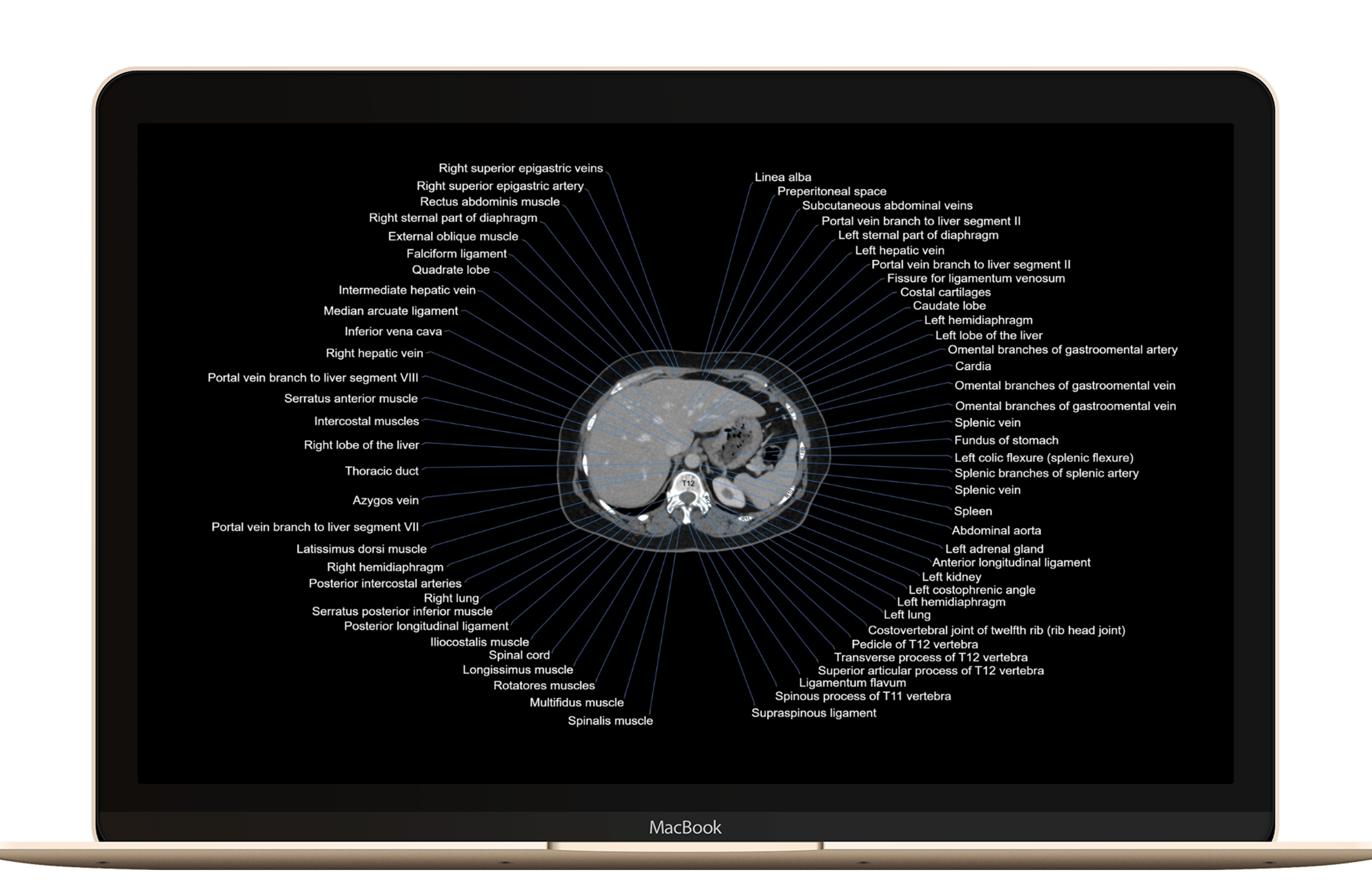 Welcome to CT Anatomy Atlas!