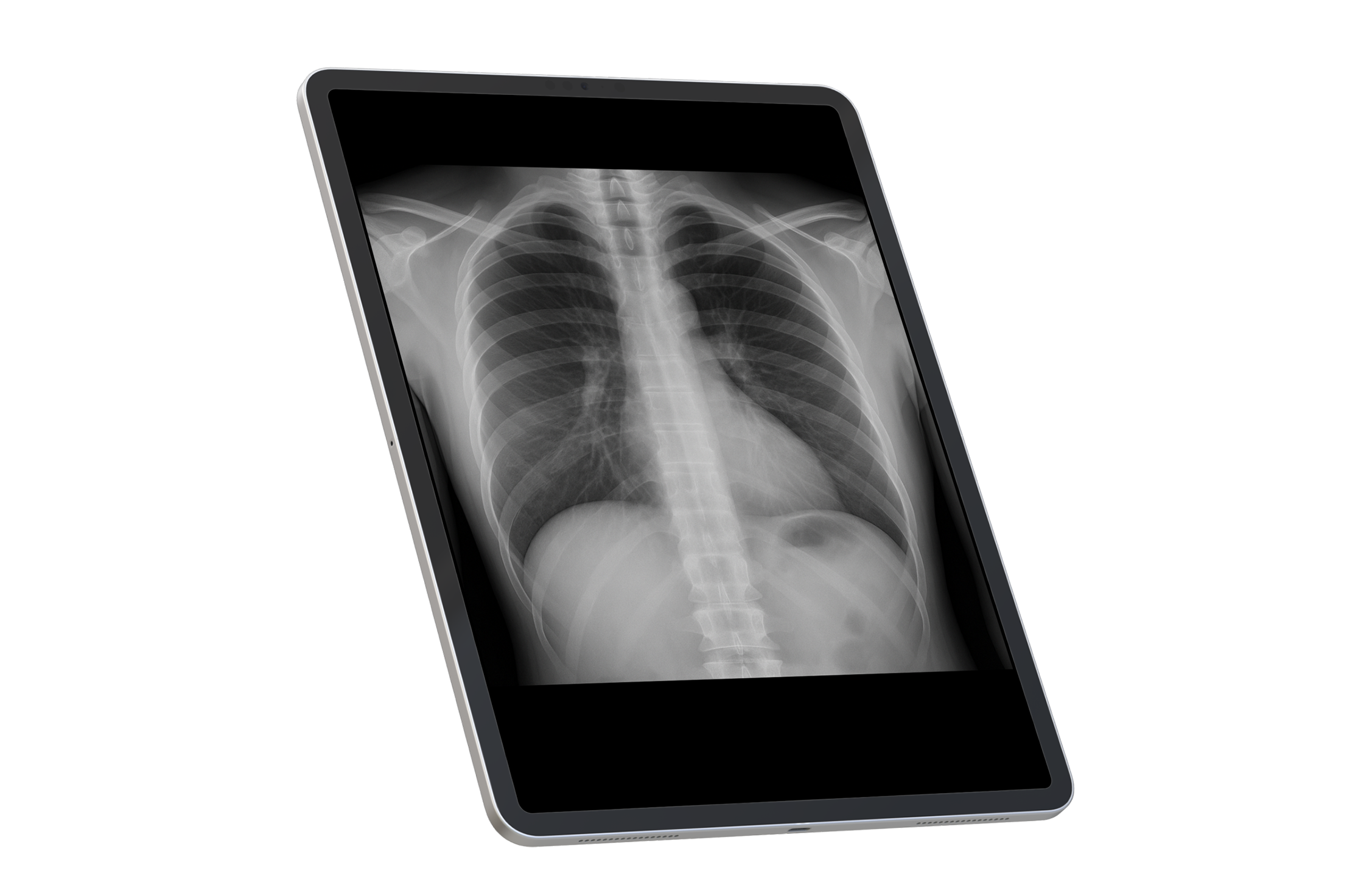 Welcome to X-Ray Anatomy Atlas!