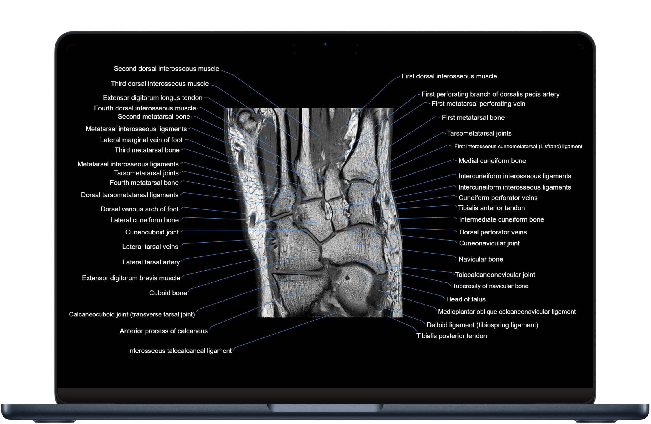 Welcome to MRI Anatomy Atlas!