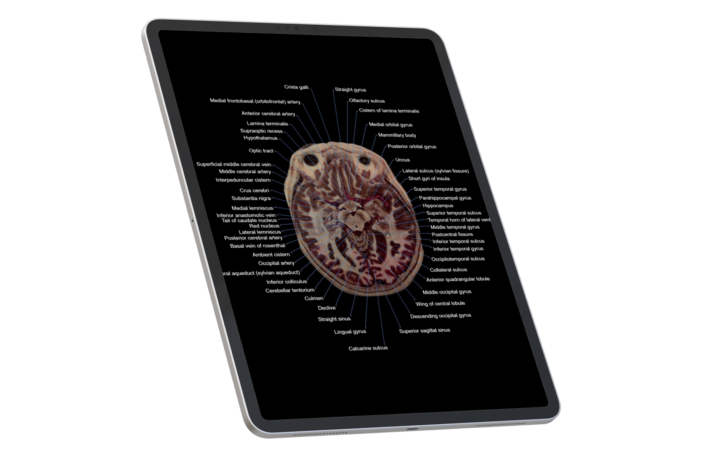 Welcome to Visible Human Anatomy Atlas!