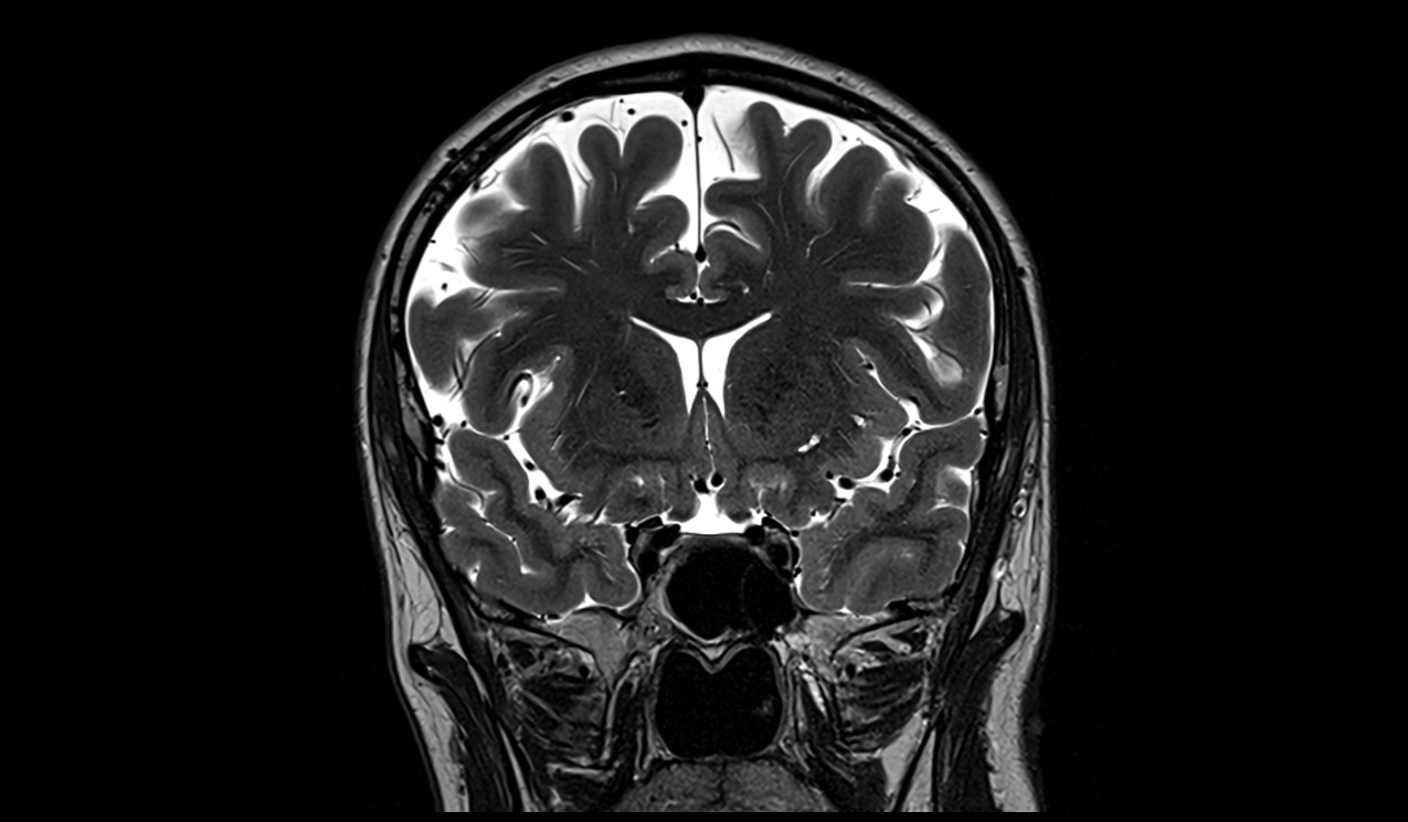 brain image