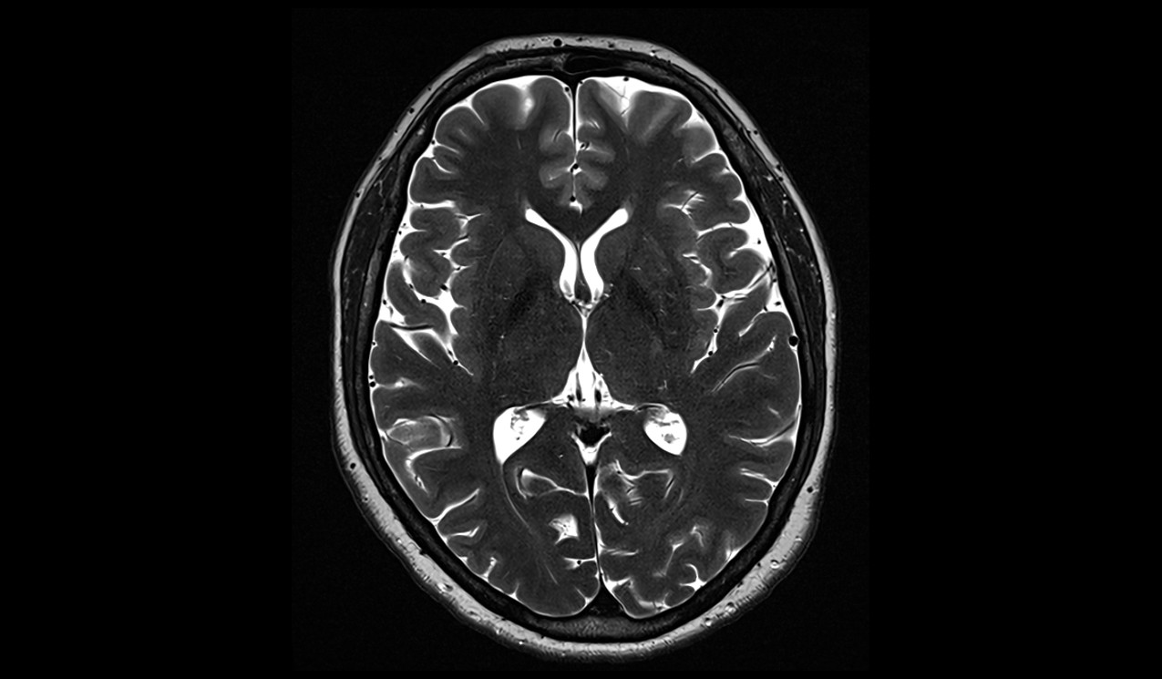 brain image