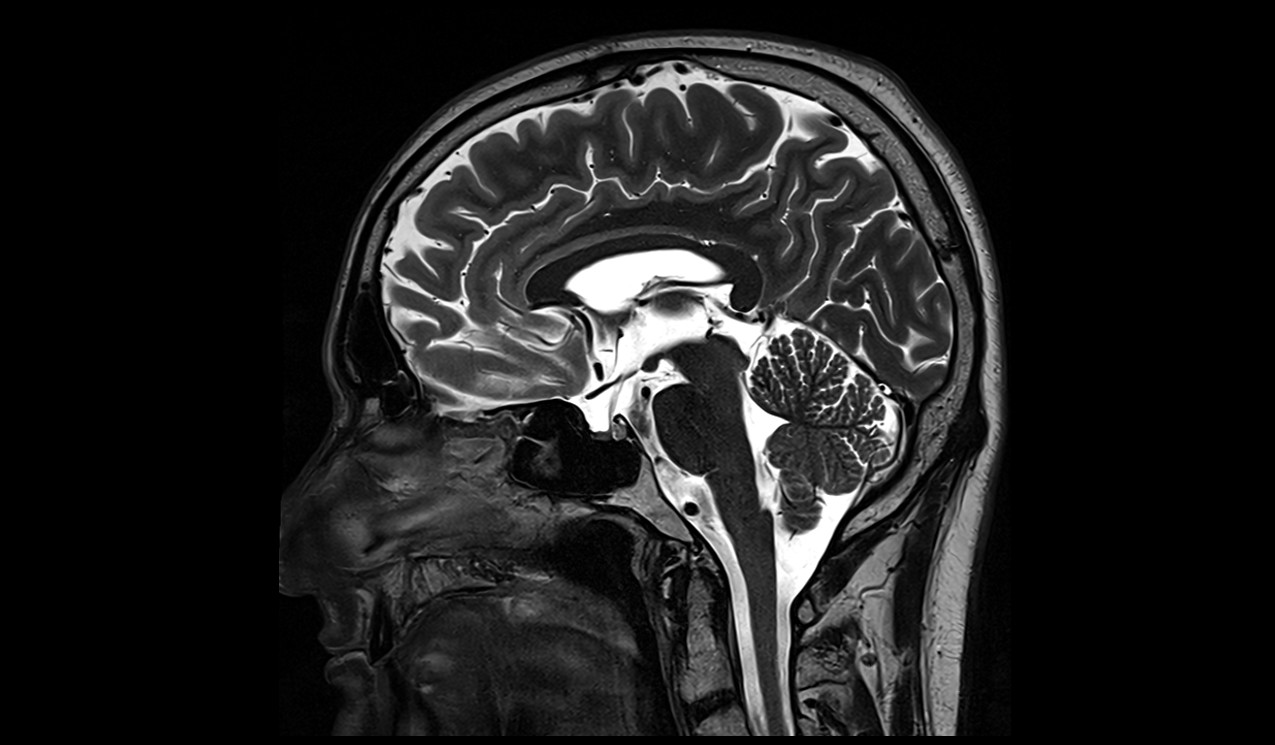 brain image