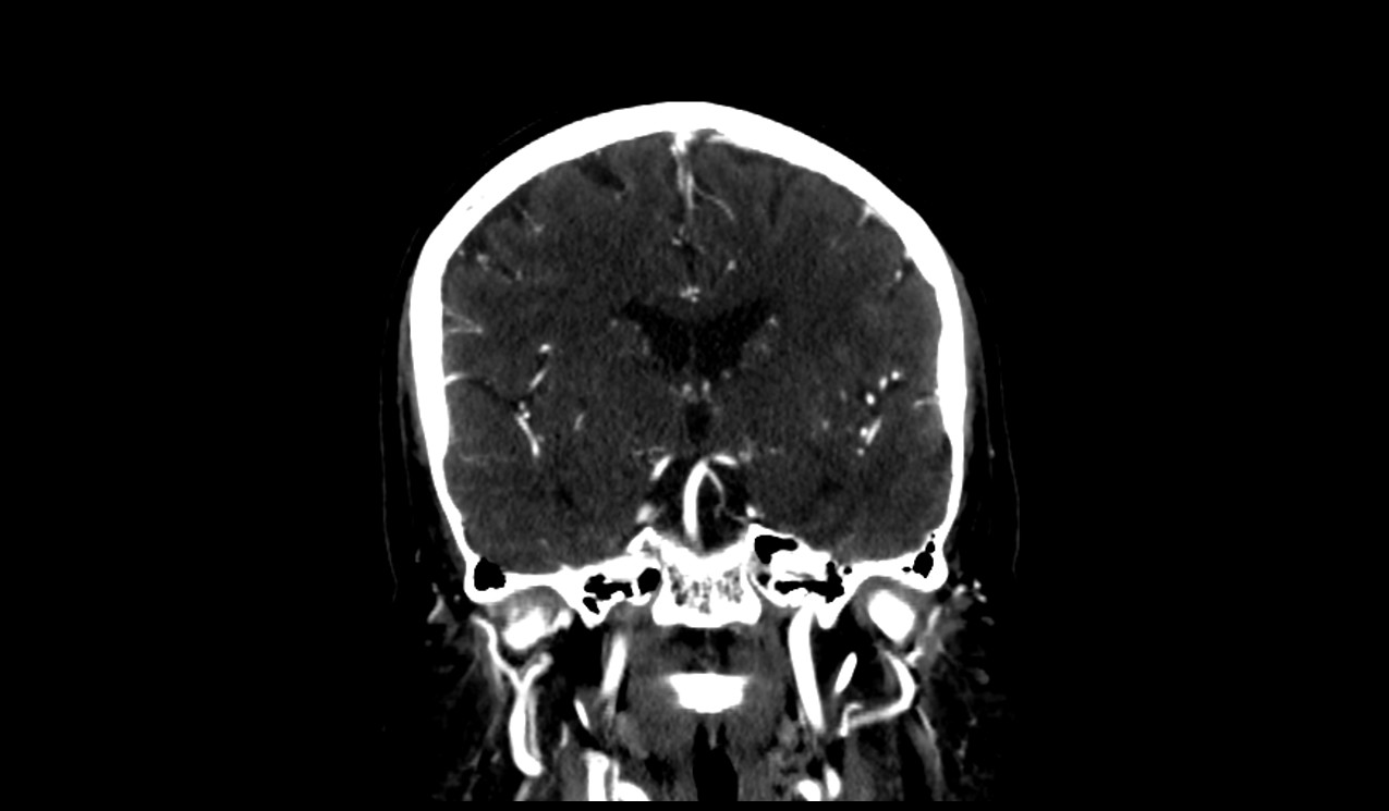 brain image