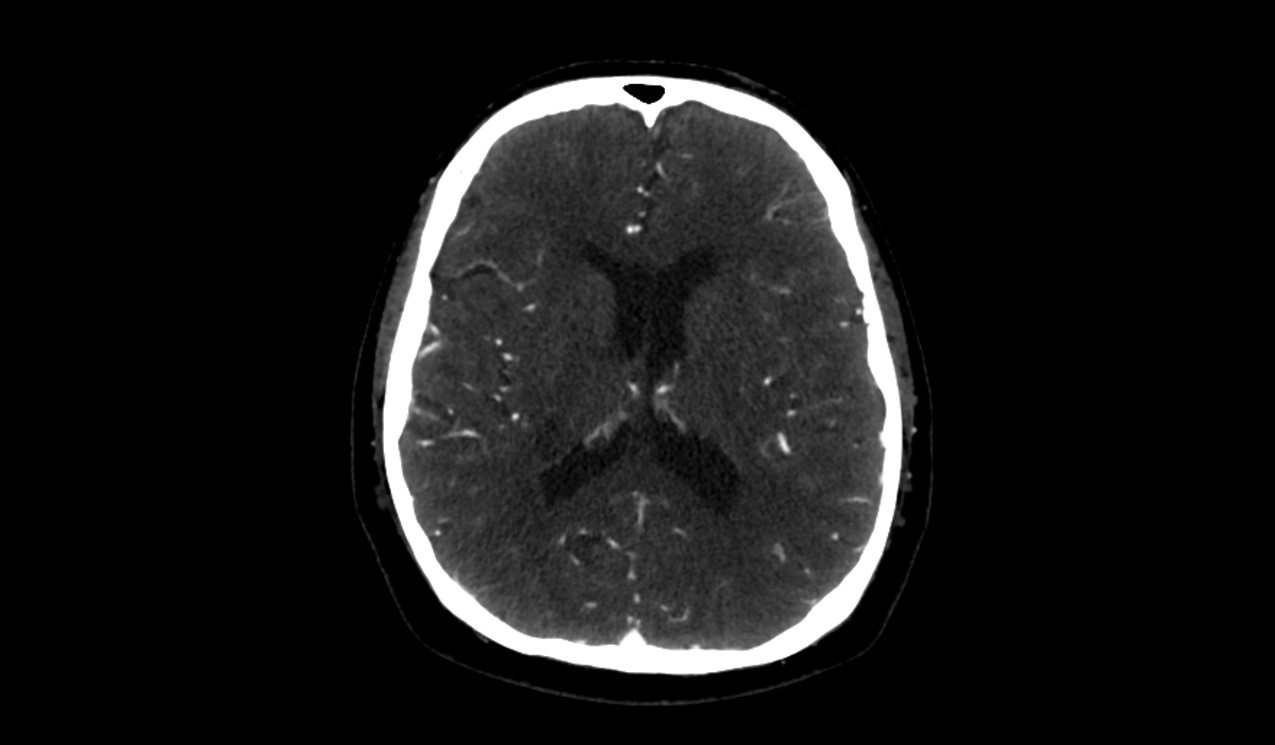 brain image