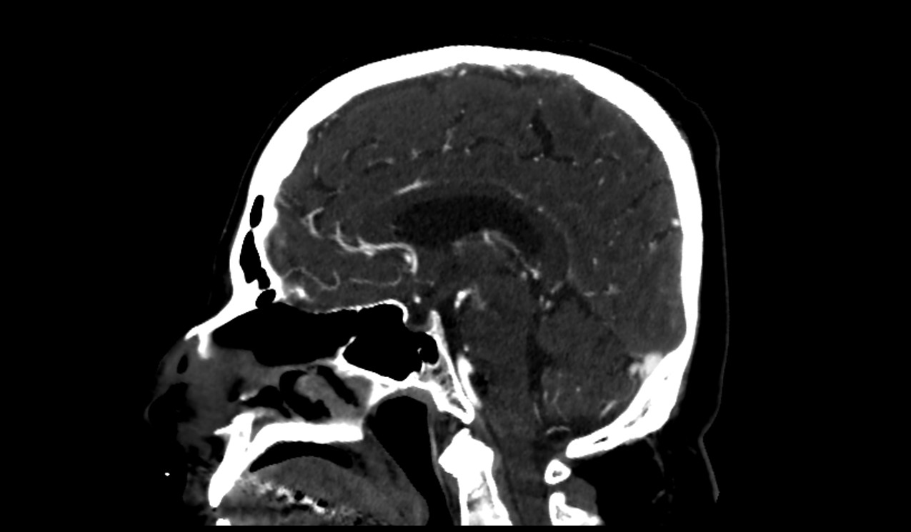 brain image