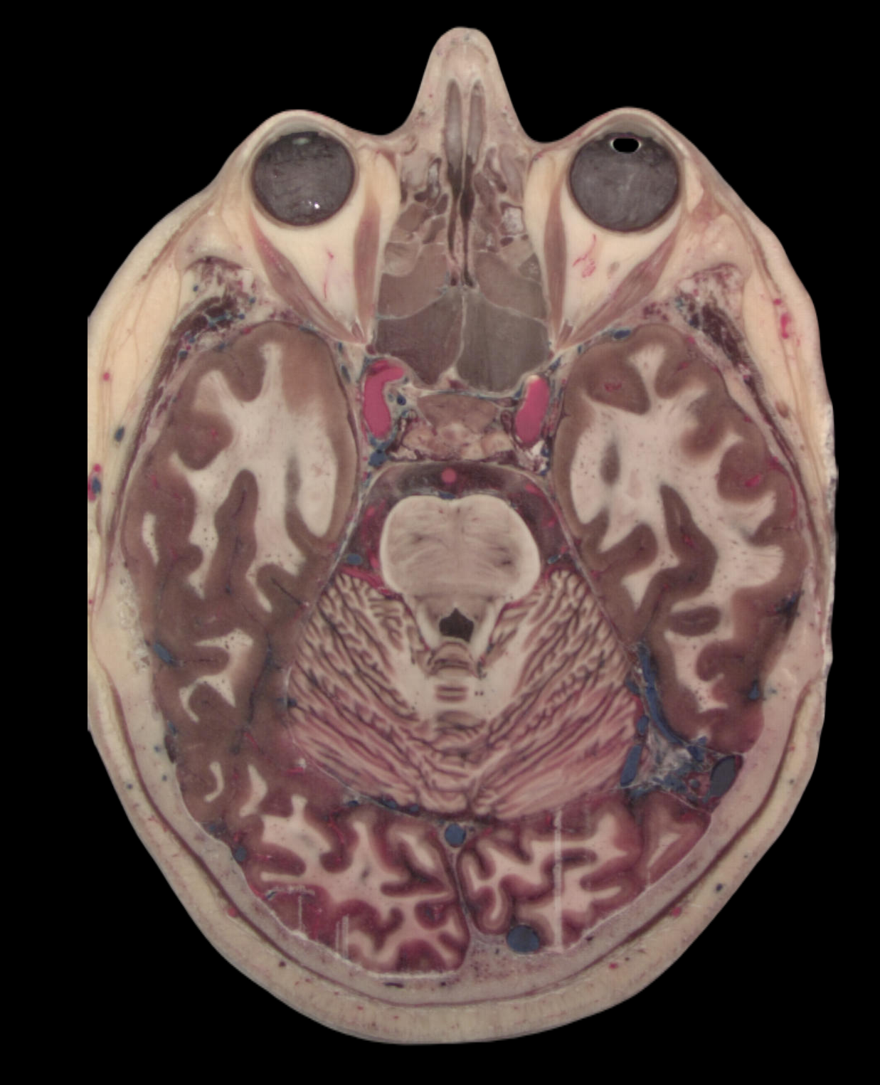 brain image