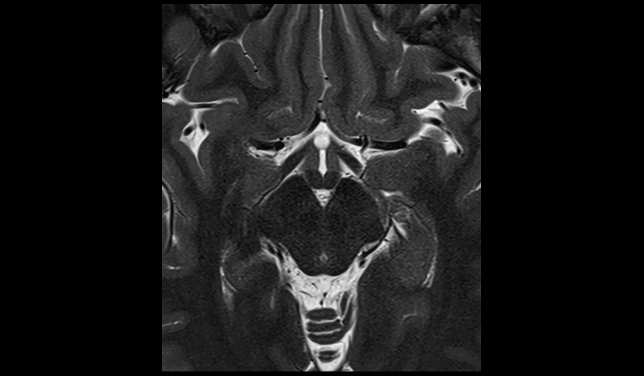 brain image