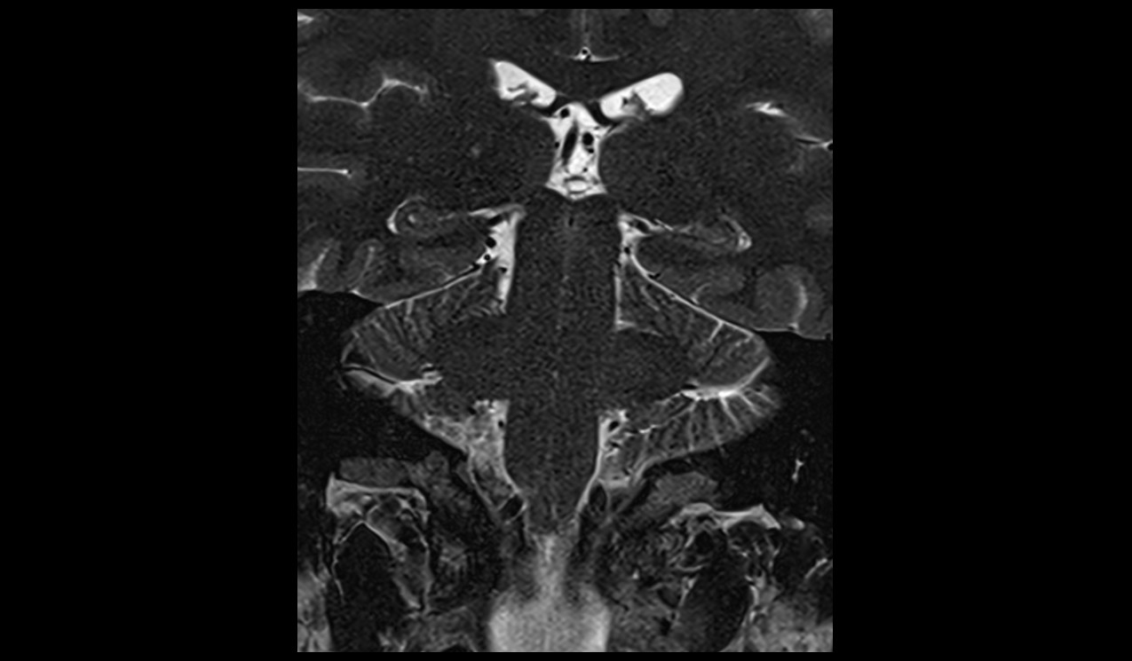 brain image