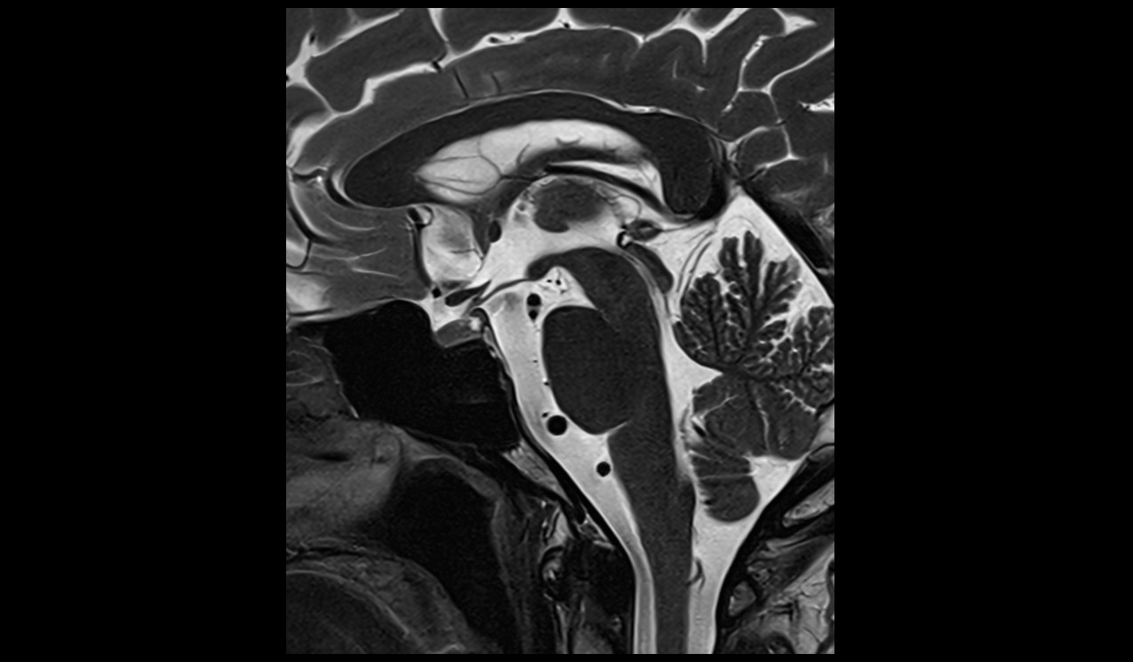 brain image