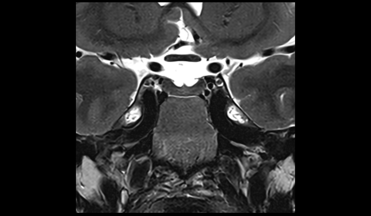 brain image