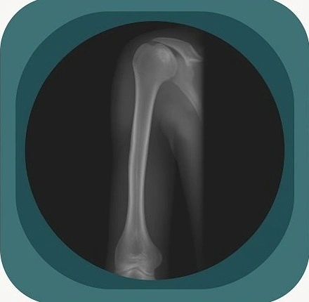 X-Ray Anatomy: Labelled Plain Film Anatomy Images Head to Toe Online