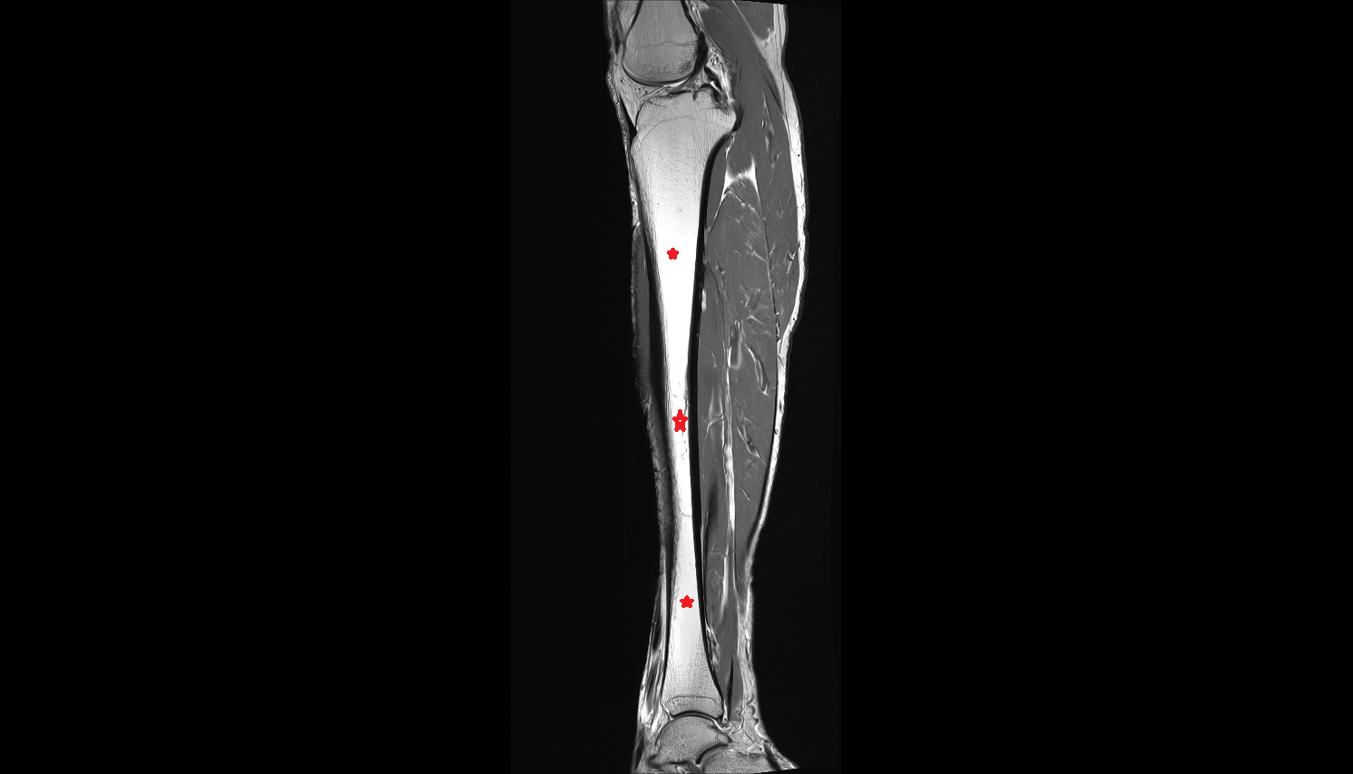 Body of tibia sagittal cross sectional anatomy 3T MRI AI enhanced  radiology  anatomy image-img-00000-00000