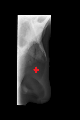 Cartilaginous part of nasal septum X RAY