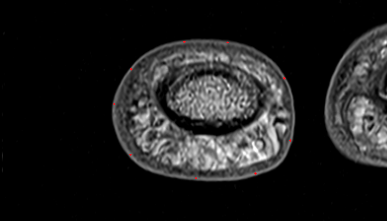 Epidermis of skin hand  MRI axial  image-img-00000-00000