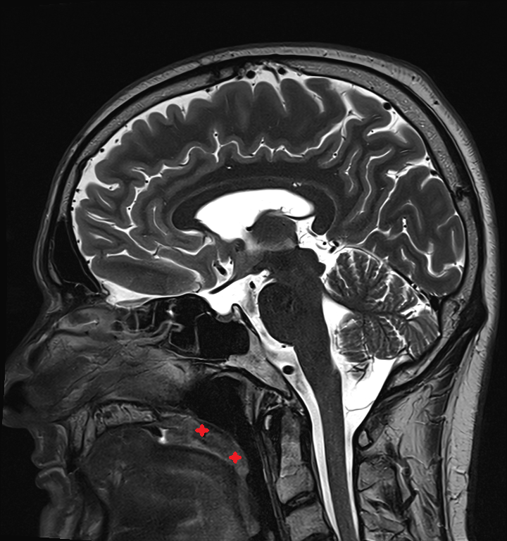 Soft palate  MRI  anatomy labelled image-img-00000-00000