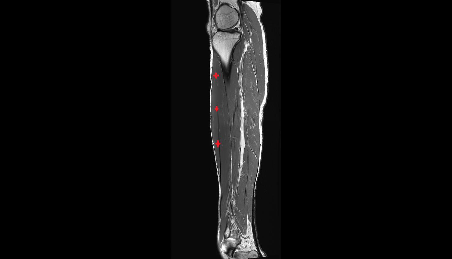 Tibialis anterior muscle  sag  cross sectional anatomy 3T MRI  radiology  anatomy image-img-00000-00000