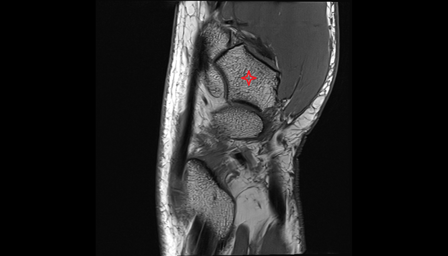 Trapezium bonesagl cross sectional anatomy 3T MRI AI enhanced radiology image-img-00000-00000