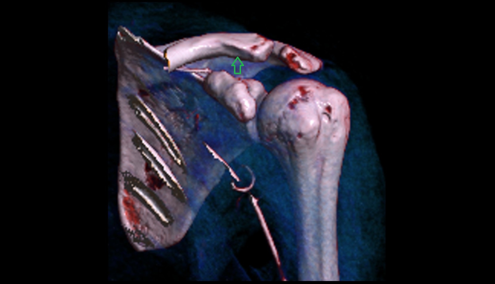 Trapezoid line 3d image