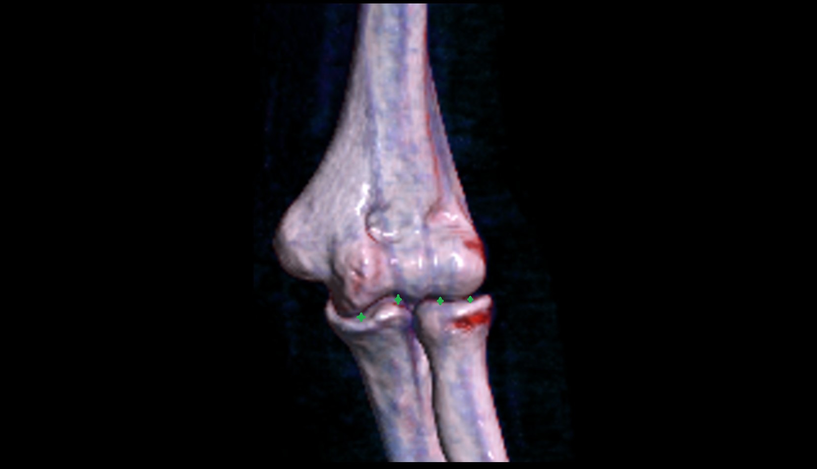 elbow joint 3d image