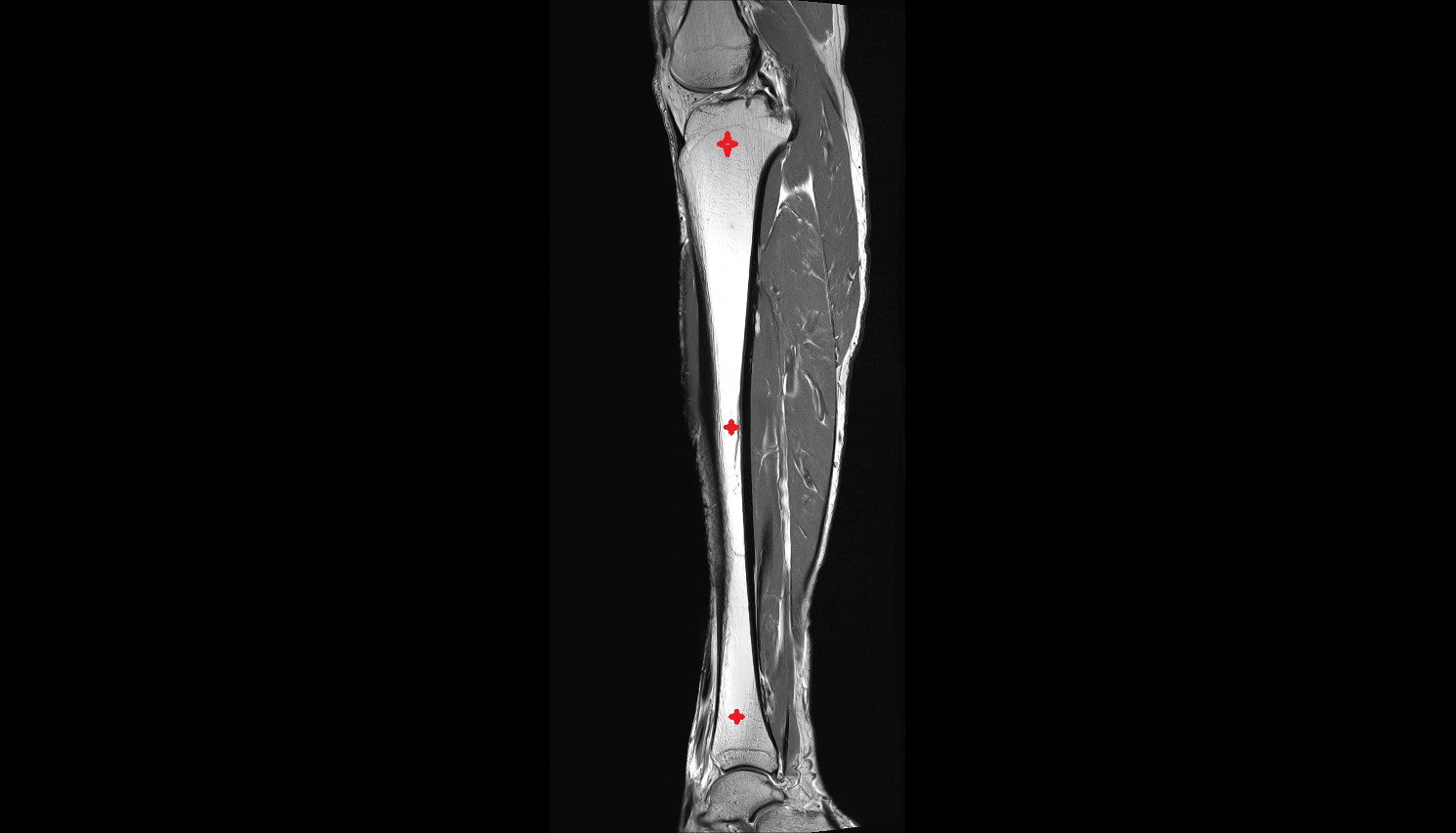 tibia sagittal cross sectional anatomy 3T MRI AI enhanced  radiology  anatomy image-img-00000-00000